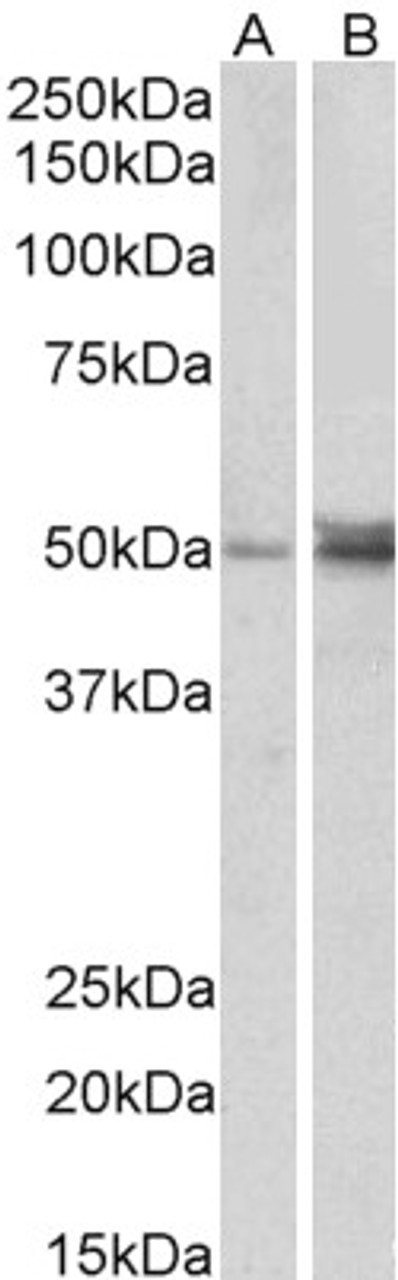 45-617 (2µg/ml) staining of K562 cell lysate (A) + peptide (B) and HeLa cell lysate (C) + peptide (D) 35µg protein in RIPA buffer) . Detected by chemiluminescence.