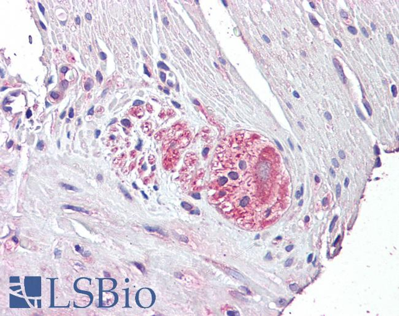 42-818 (0.03ug/ml) staining of Human Heart lysate (35ug protein in RIPA buffer) . Detected by chemiluminescence.