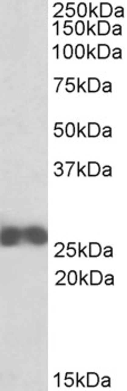 42-829 (0.3ug/ml) staining of NIH3T3 (A) , Mouse Spleen (B) , Rat Spleen (C) ) lysates (35ug protein in RIPA buffer) . Primary incubation was 1 hour. Detected by chemiluminescence.