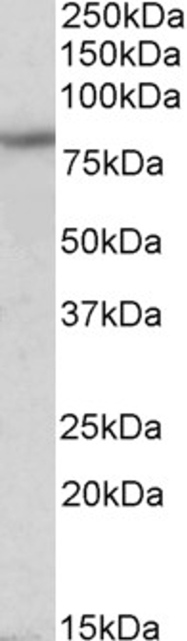 42-836 (0.1ug/ml) staining of Human Heart lysate (35ug protein in RIPA buffer) . Primary incubation was 1 hour. Detected by chemiluminescence.