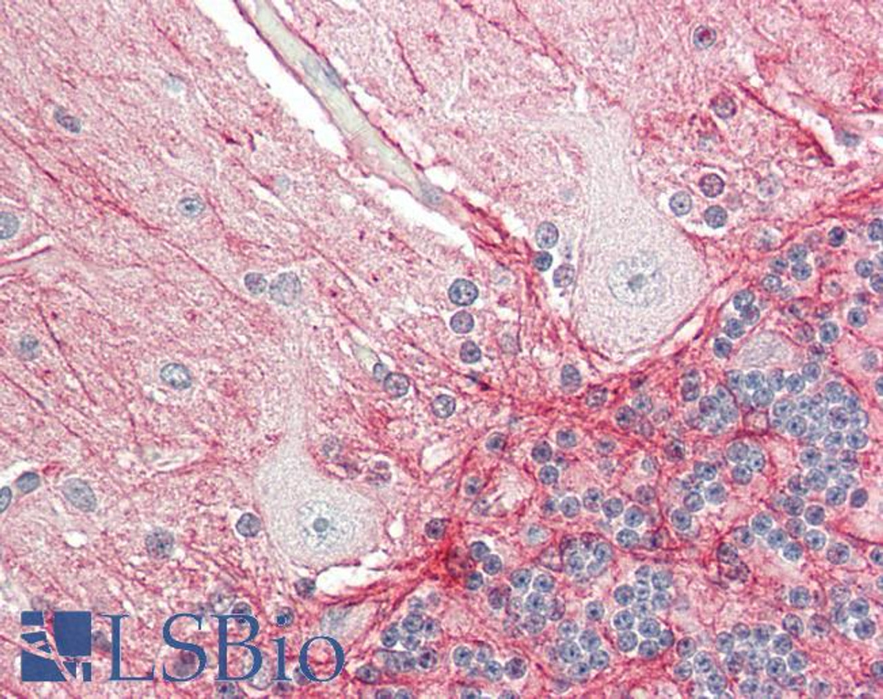 42-855 (0.1ug/ml) staining of Human Kidney lysate (35ug protein in RIPA buffer) . Primary incubation was 1 hour. Detected by chemiluminescence.