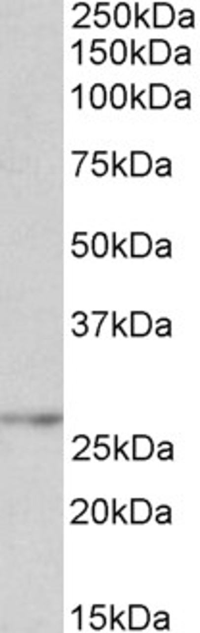 42-869 (0.1ug/ml) staining of NIH3T3 lysate (35ug protein in RIPA buffer) . Primary incubation was 1 hour. Detected by chemiluminescence.