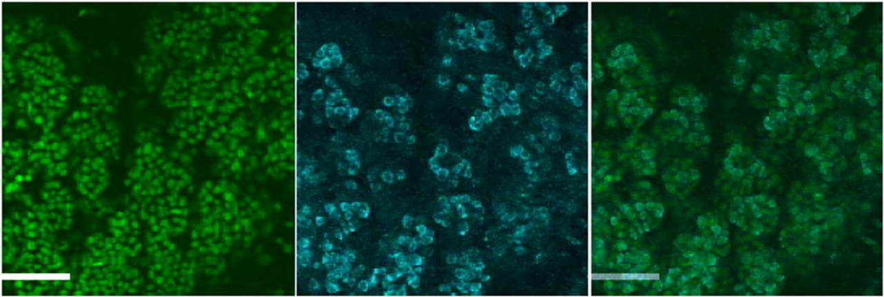 42-872 (0.5ug/ml) staining of Human Thyroid gland lysate (35ug protein in RIPA buffer) . Primary incubation was 1 hour. Detected by chemiluminescence.