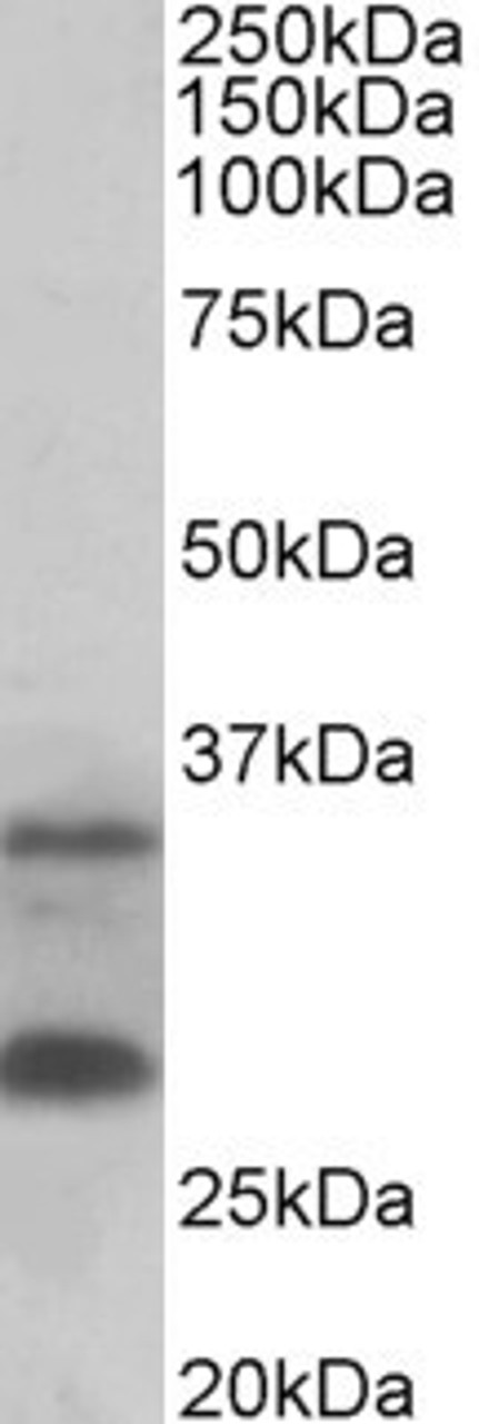 42-877 (0.5ug/ml) staining of Human Spleen lysate (35ug protein in RIPA buffer) . Primary incubation was 1 hour. Detected by chemiluminescence.