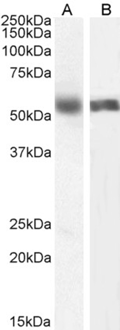 42-881 (0.1ug/ml) staining of Human Liver lysate (35ug protein in RIPA buffer) . Primary incubation was 1 hour. Detected by chemiluminescence.