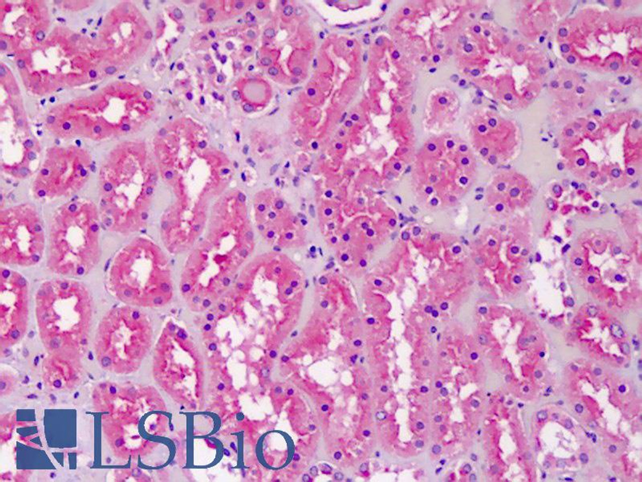 42-900 (0.01ug/ml) staining of Mouse Heart lysate (35ug protein in RIPA buffer) . Primary incubation was 1 hour. Detected by chemiluminescence.