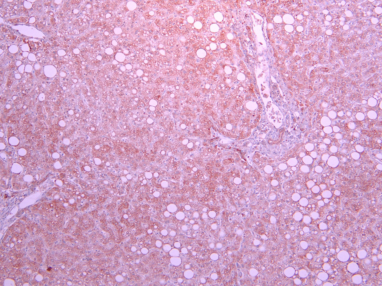 42-922 (0.5ug/ml) staining of Mouse fetal Kidney lysate (35ug protein in RIPA buffer) . Primary incubation was 1 hour. Detected by chemiluminescence.