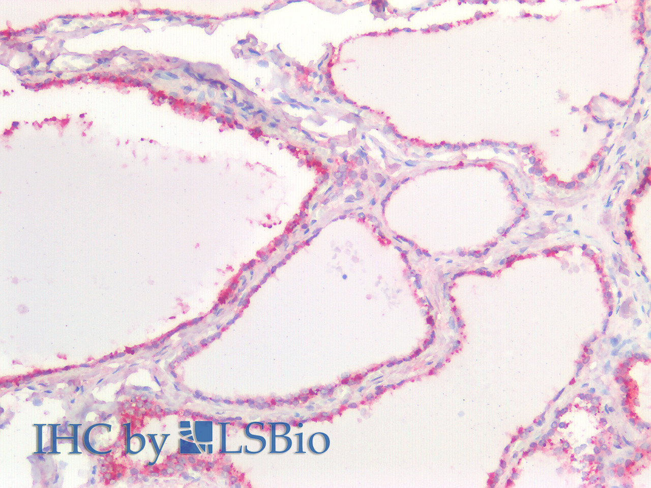 42-927 (1ug/ml) staining of Rat Heart lysate (35ug protein in RIPA buffer) . Primary incubation was 1 hour. Detected by chemiluminescence.