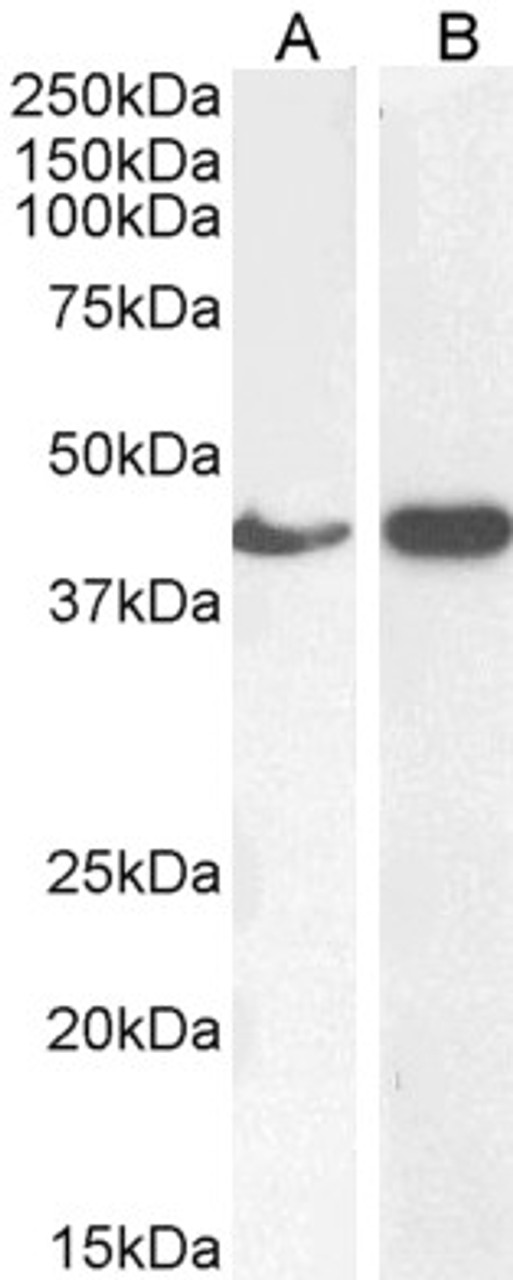 45-198 (0.3ug/ml) staining of HeLa (A) and (0.5ug/ml) NIH3T3 (B) cell lysate (35ug protein in RIPA buffer) . Detected by chemiluminescence.