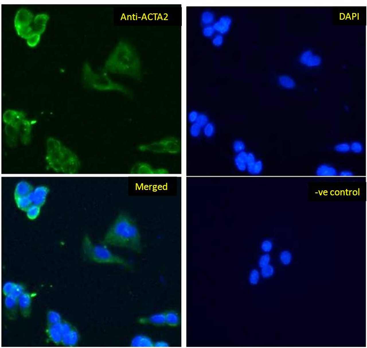45-198 Immunofluorescence analysis of paraformaldehyde fixed HepG2 cells, permeabilized with 0.15% Triton. Primary incubation 1hr (10ug/ml) followed by Alexa Fluor 488 secondary antibody (1ug/ml) , showing cytoplasmic staining. The nuclear stain is DAPI (
