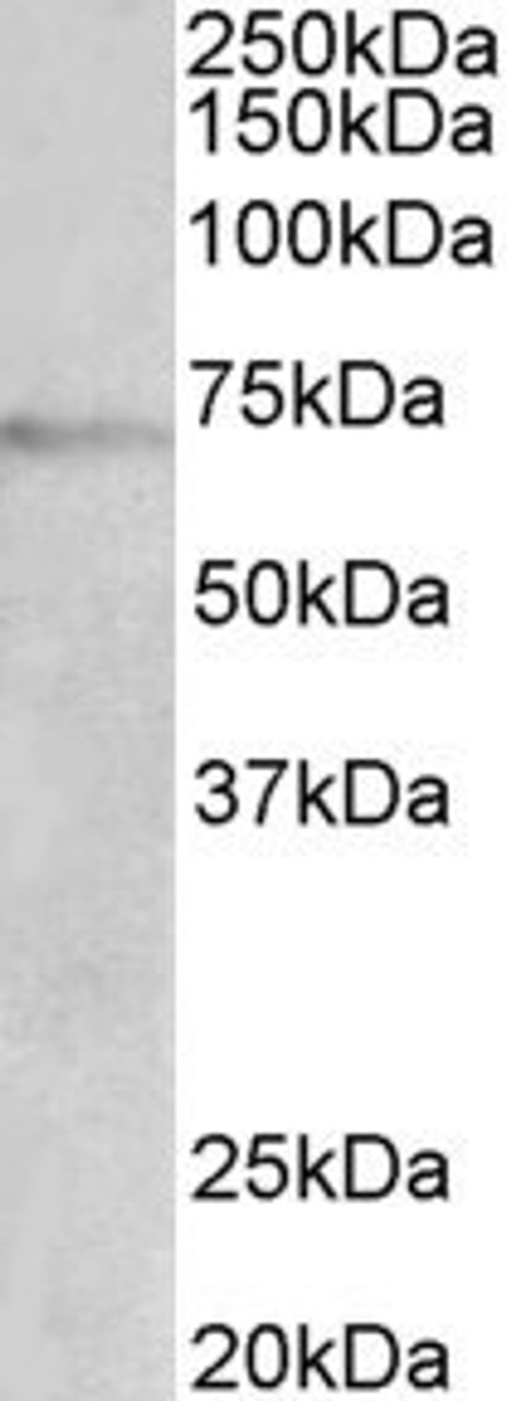 ChIP of 2ug 42-976 with 1ug MCF7 chromatin using the Chromatrap® spin column sonication kit (Protein G) measuring H3 enrichment onto the p21 locus.