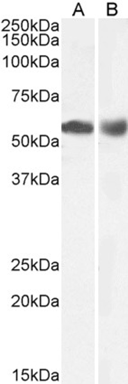 42-979 (1ug/ml) staining of A431 lysate (35ug protein in RIPA buffer) . Primary incubation was 1 hour. Detected by chemiluminescence.