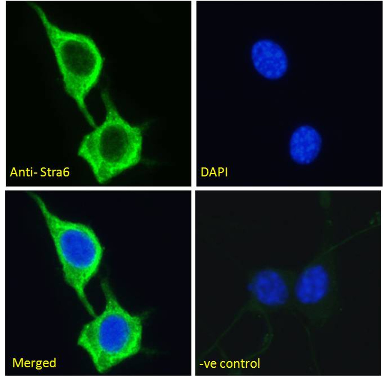 43-007 (1ug/ml) staining of Mouse Brain and KO Mouse Brain lysates (35ug protein in RIPA buffer) . Primary incubation was 1 hour. Detected by chemiluminescence.