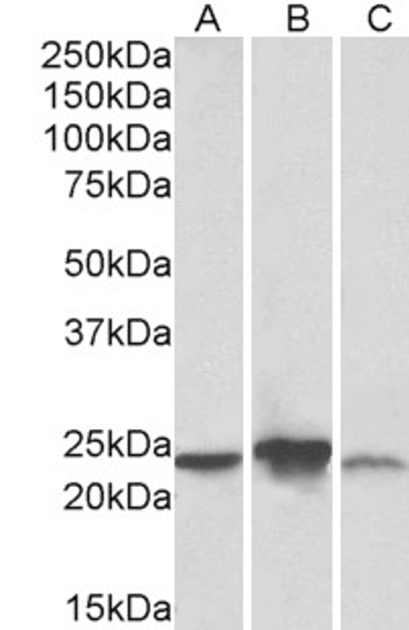 43-045 (1ug/ml) staining of HeLa lysate (35ug protein in RIPA buffer) . Primary incubation was 1 hour. Detected by chemiluminescence.