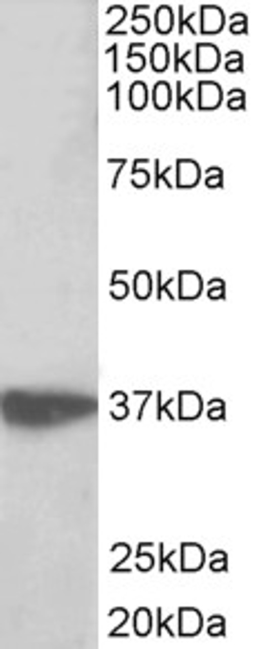 43-047 (1ug/ml) staining of MCF7 lysate (35ug protein in RIPA buffer) . Primary incubation was 1 hour. Detected by chemiluminescence.