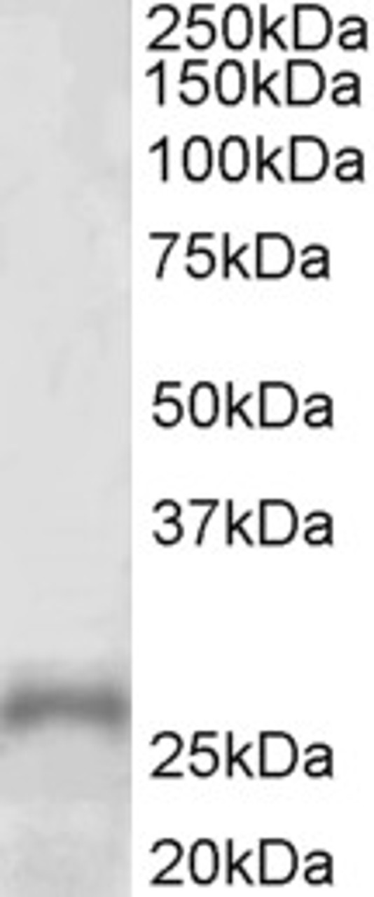 43-062 (1ug/ml) staining of nuclear NIH3T3 (A) and nuclear HeLa (B) lysates (35ug protein in RIPA buffer) . Primary incubation was 1 hour. Detected by chemiluminescence.