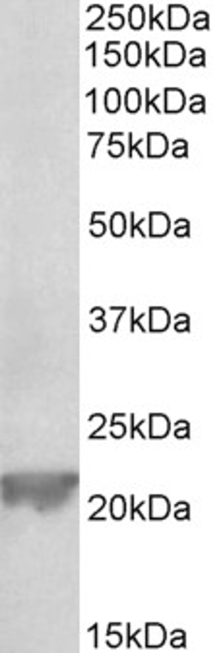 43-068 (1ug/ml) staining of Human Adrenal Gland lysate (35ug protein in RIPA buffer) . Primary incubation was 1 hour. Detected by chemiluminescence.