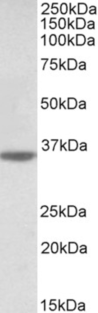 43-069 (1ug/ml) staining of Amygdala lysate (35ug protein in RIPA buffer) . Primary incubation was 1 hour. Detected by chemiluminescence.