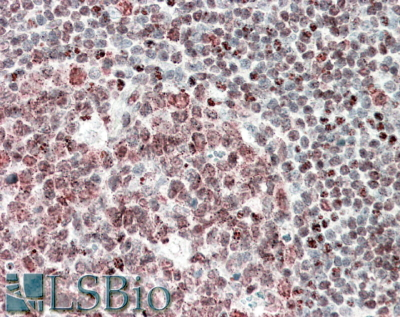 43-079 (0.1ug/ml) staining of HEK293 lysate (35ug protein in RIPA buffer) . Primary incubation was 1 hour. Detected by chemiluminescence.