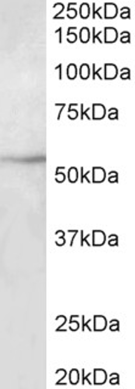 43-091 (2ug/ml) staining of Peripheral Blood Lymphocytes lysate (35ug protein in RIPA buffer) . Detected by chemiluminescence.