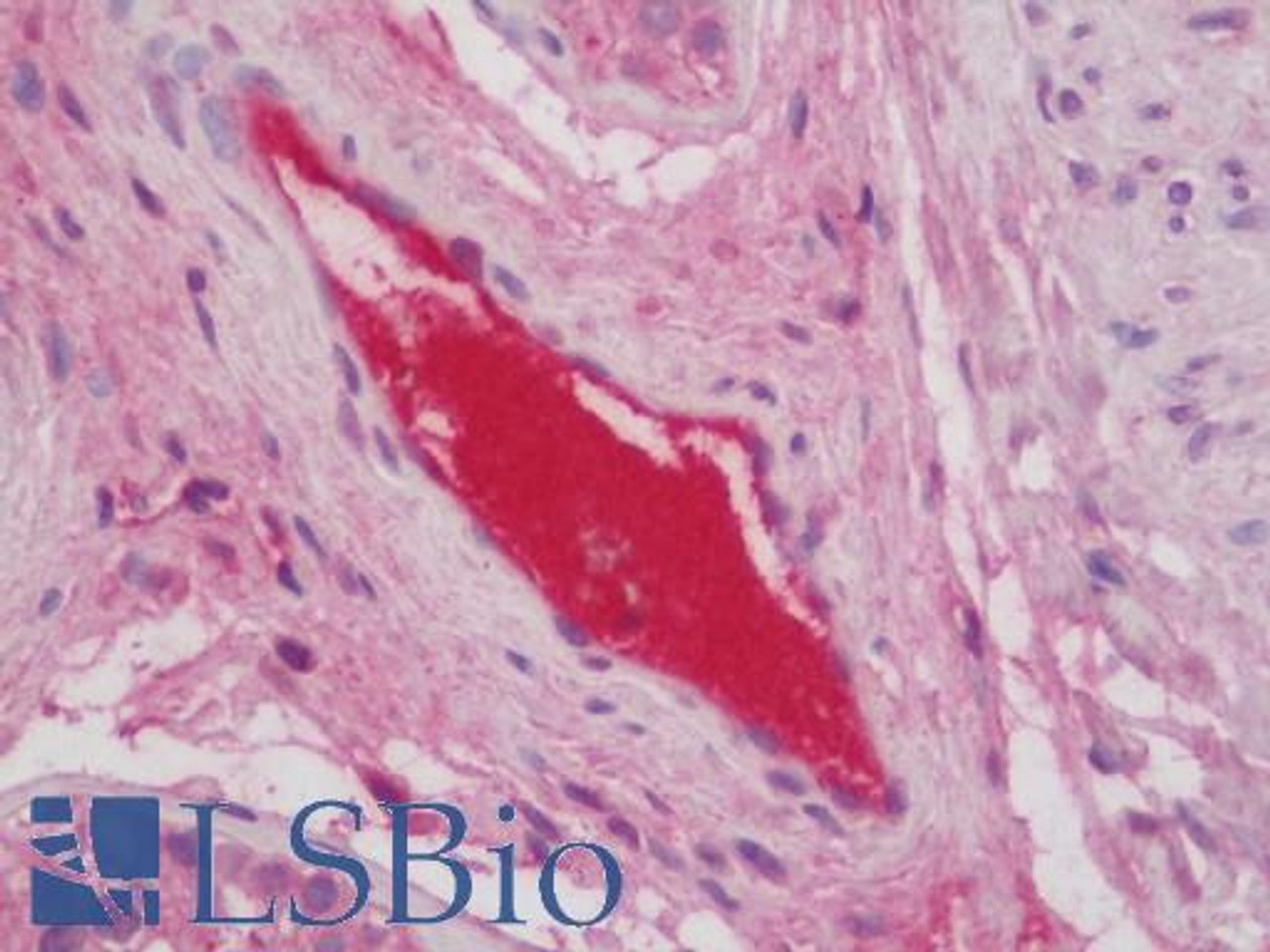 43-095 (0.3ug/ml) staining of Human Frontal Cortex lysate (35ug protein in RIPA buffer) . Primary incubation was 1 hour. Detected by chemiluminescence.