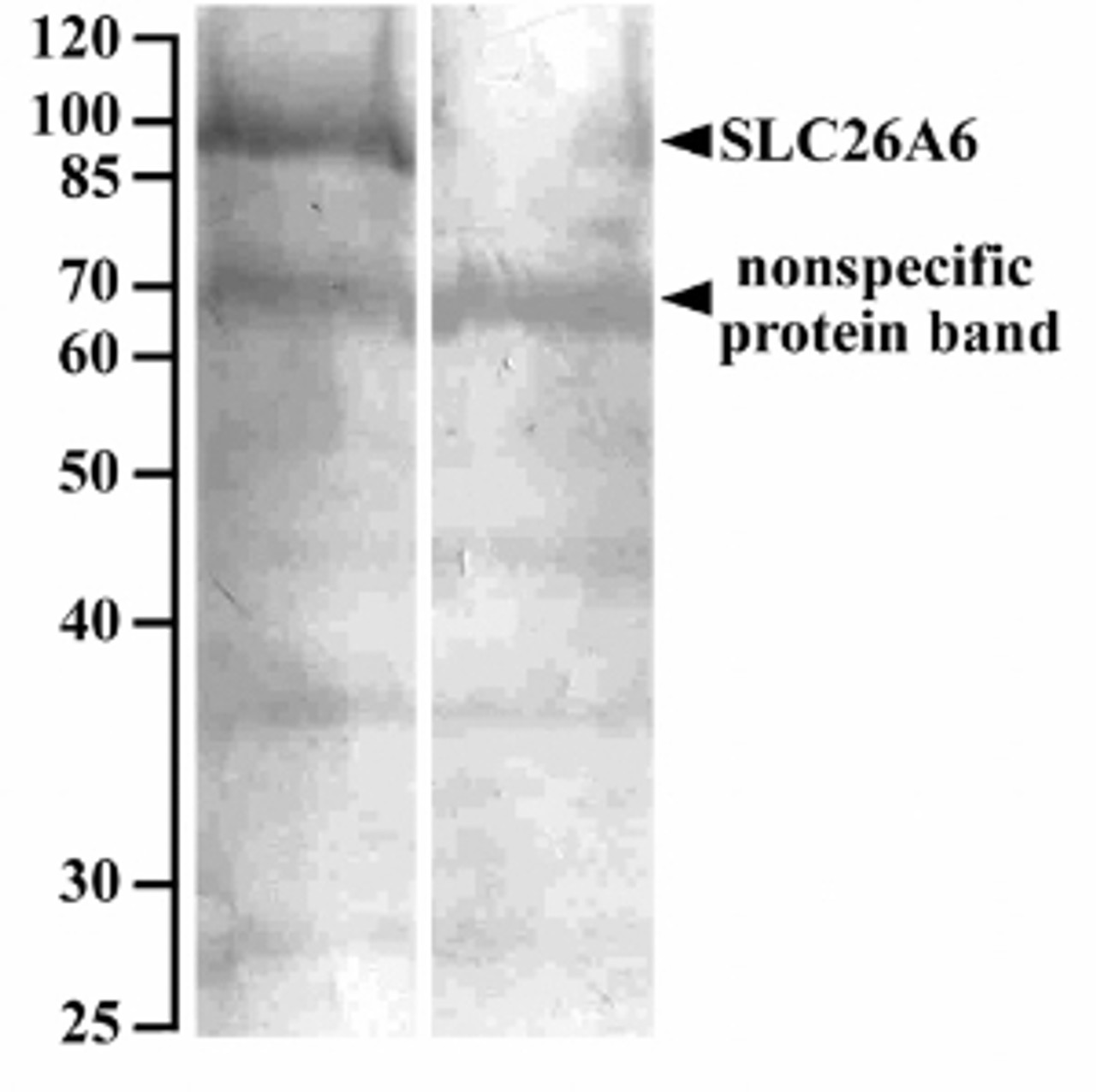 43-103 (0.3ug/ml) staining of Mouse Eye lysate (35ug protein in RIPA buffer) . Primary incubation was 1 hour. Detected by chemiluminescence.