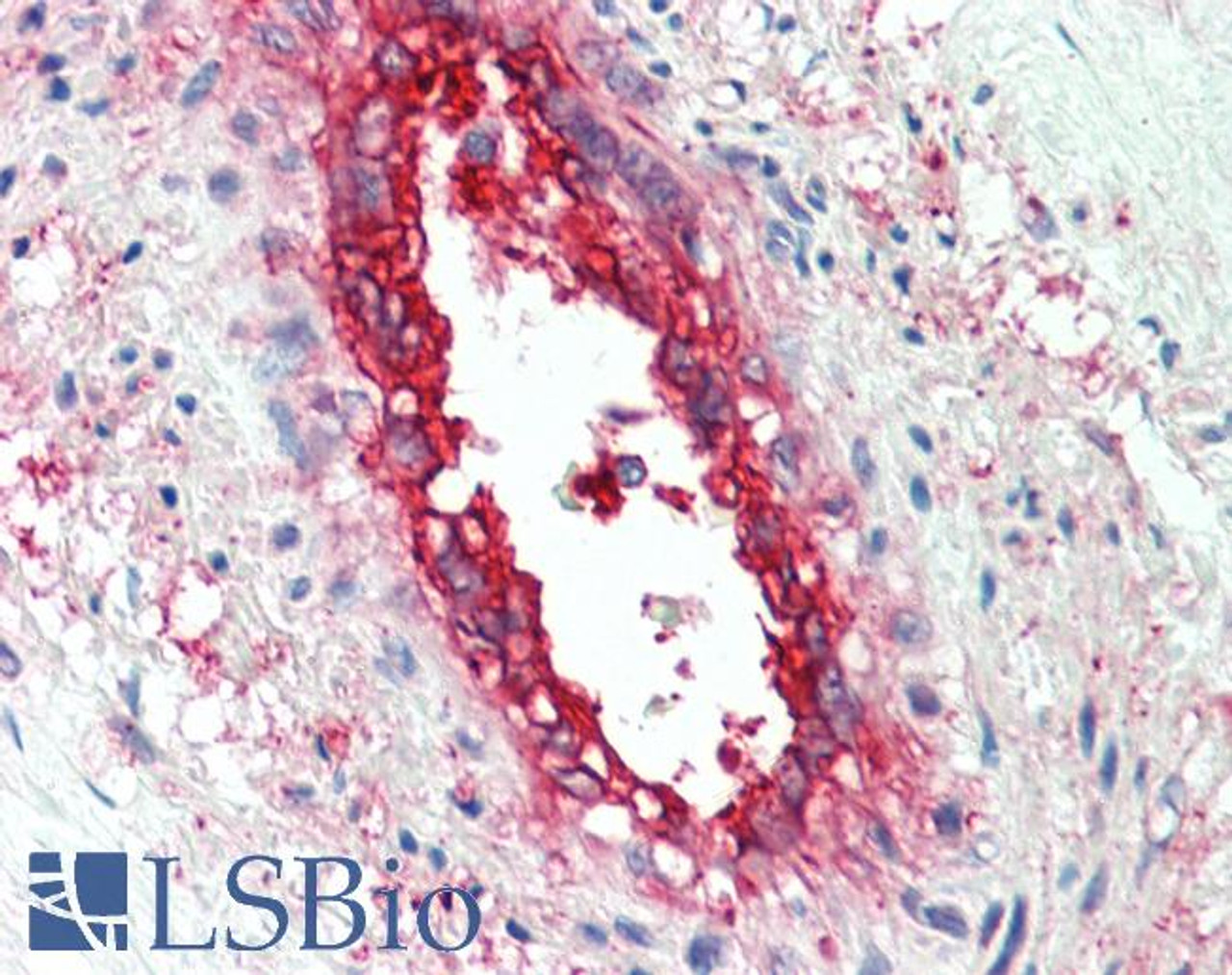 45-523 (0.3µg/ml) staining of Human Lung lysate (35µg protein in RIPA buffer) . Detected by chemiluminescence.