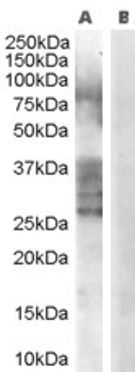 HEK293 lysate (10ug protein in RIPA buffer) over expressing Human MKRN1 with DYKDDDDK tag probed with 43-114 (1ug/ml) in Lane A and probed with anti- DYKDDDDK Tag (1/1000) in lane C. Mock-transfected HEK293 probed with 43-114 (1mg/ml) in Lane B. Primary