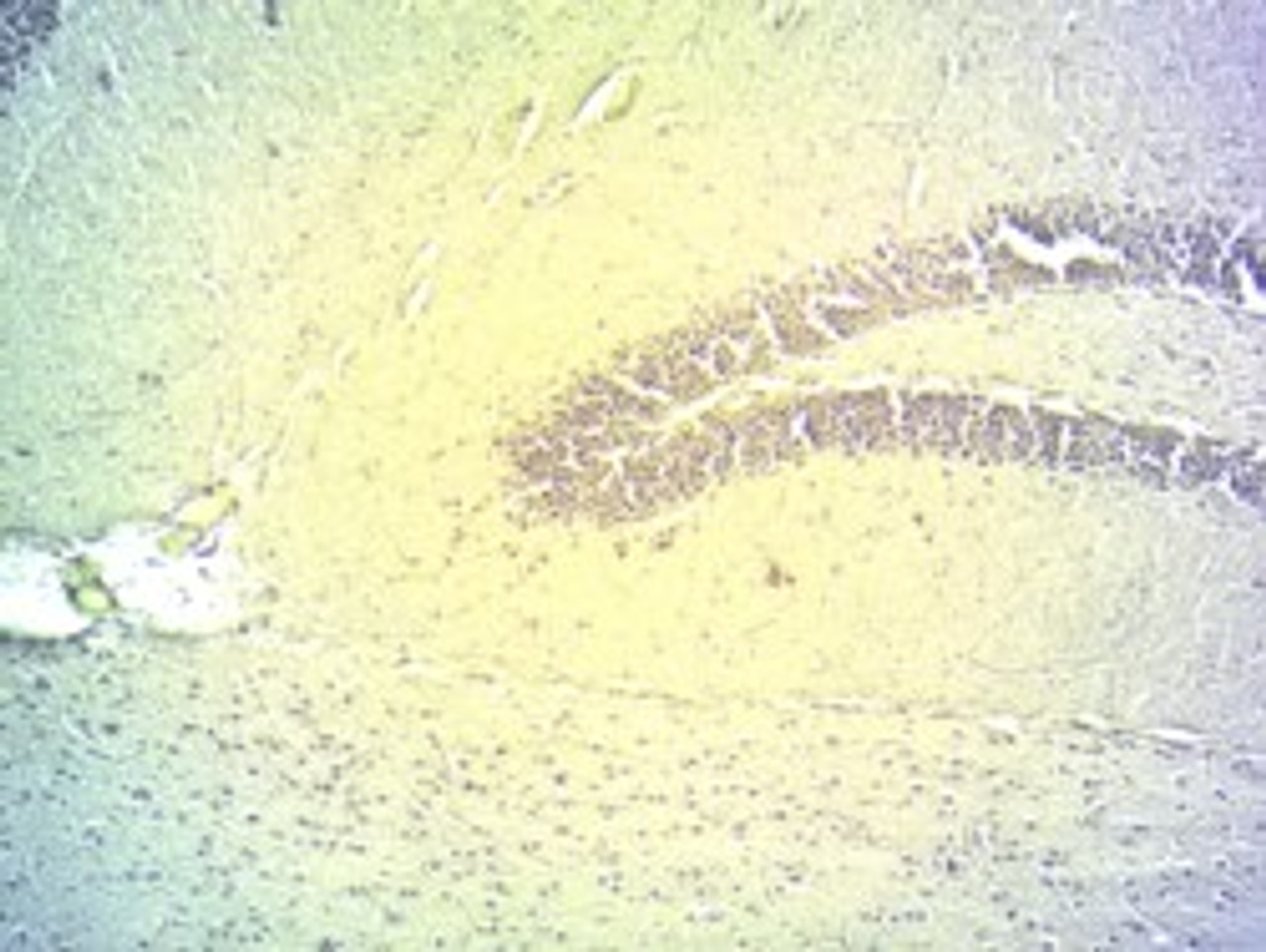 43-120 (0.1ug/ml) staining of Human Skeletal Muscle lysate (35ug protein in RIPA buffer) . Detected by chemiluminescence.