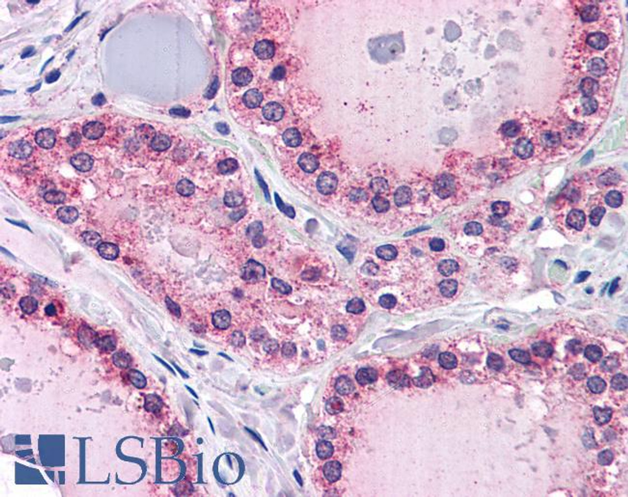 43-121 (2ug/ml) staining of paraffin embedded Human Kidney. Steamed antigen retrieval with citrate buffer pH 6, HRP-staining.