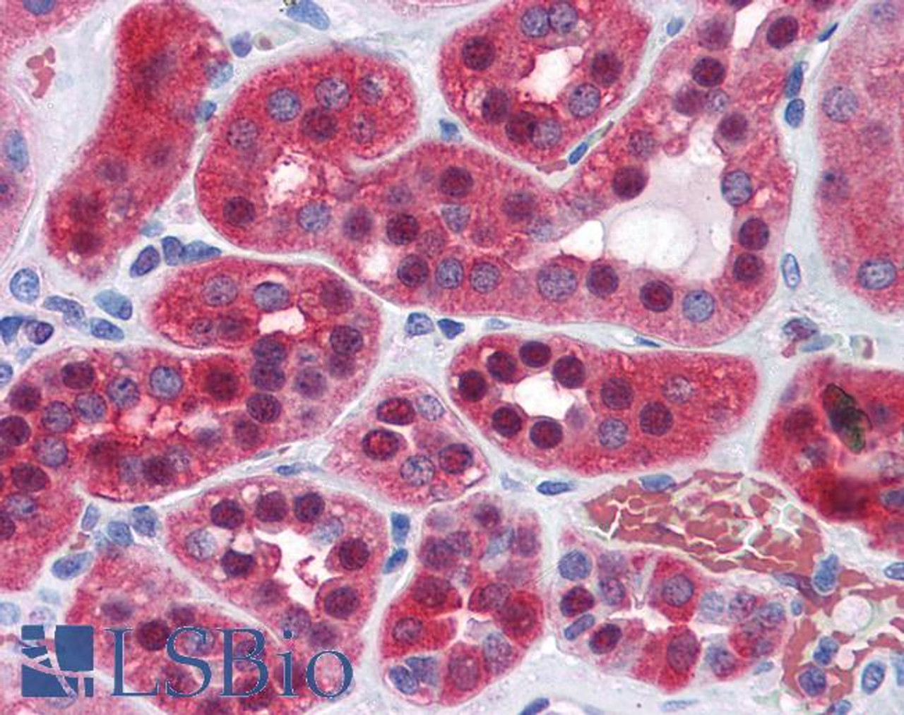 43-136 (0.3ug/ml) staining of Human Heart lysate (35ug protein in RIPA buffer) . Detected by chemiluminescence.