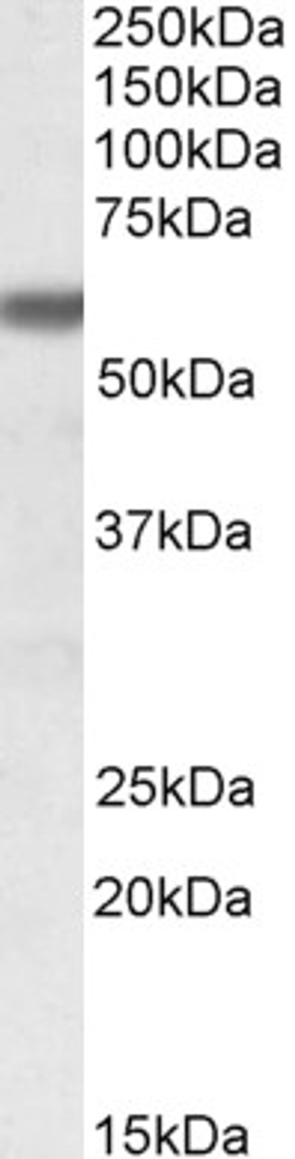 43-136 (0.05ug/ml) staining of HeLa (A) , A431 (B) , A549 (C) , MCF7 (D) , Jurkat (E) and K562 (F) lysates (35ug protein in RIPA buffer) . Detected by chemiluminescence.