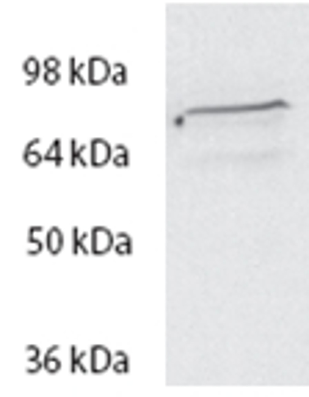 43-139 (5ug/ml) staining of paraffin embedded Human Breast Cancer. Heated antigen retrieval with citrate buffer pH 6, DAB-staining.