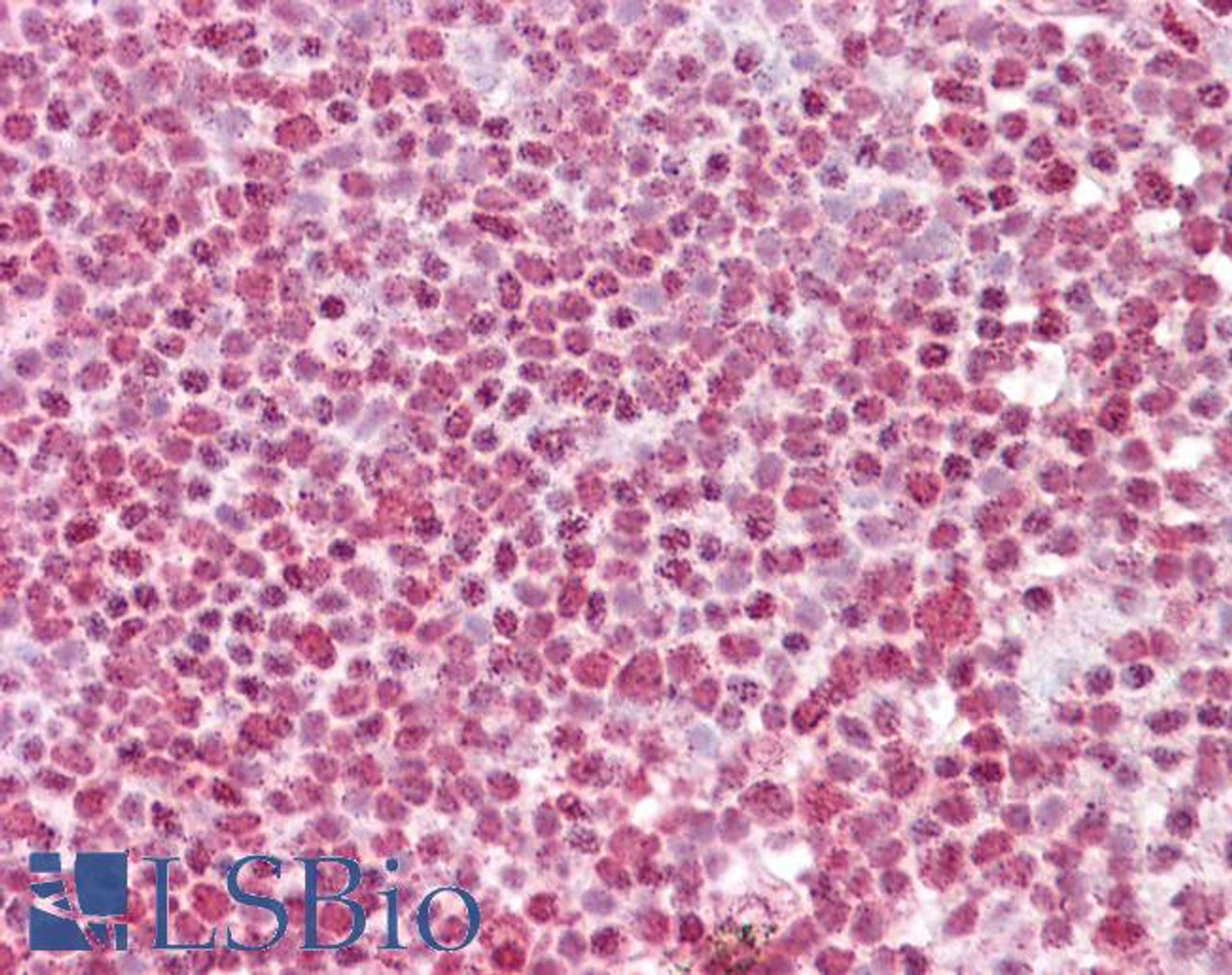 43-141 (1ug/ml) staining of Human Peripheral Lymphocytes lysate (35ug protein in RIPA buffer) . Primary incubation was 1 hour. Detected by chemiluminescence.