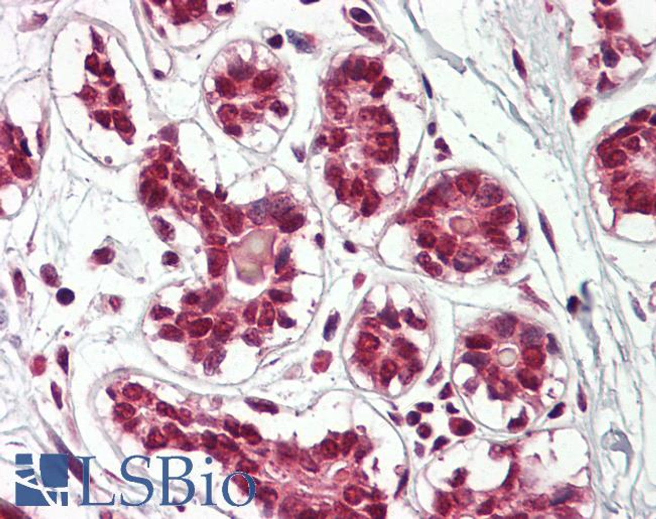 43-145 (2ug/ml) staining of paraffin embedded Human Kidney. Microwaved antigen retrieval with citrate buffer pH 6, HRP-staining.
