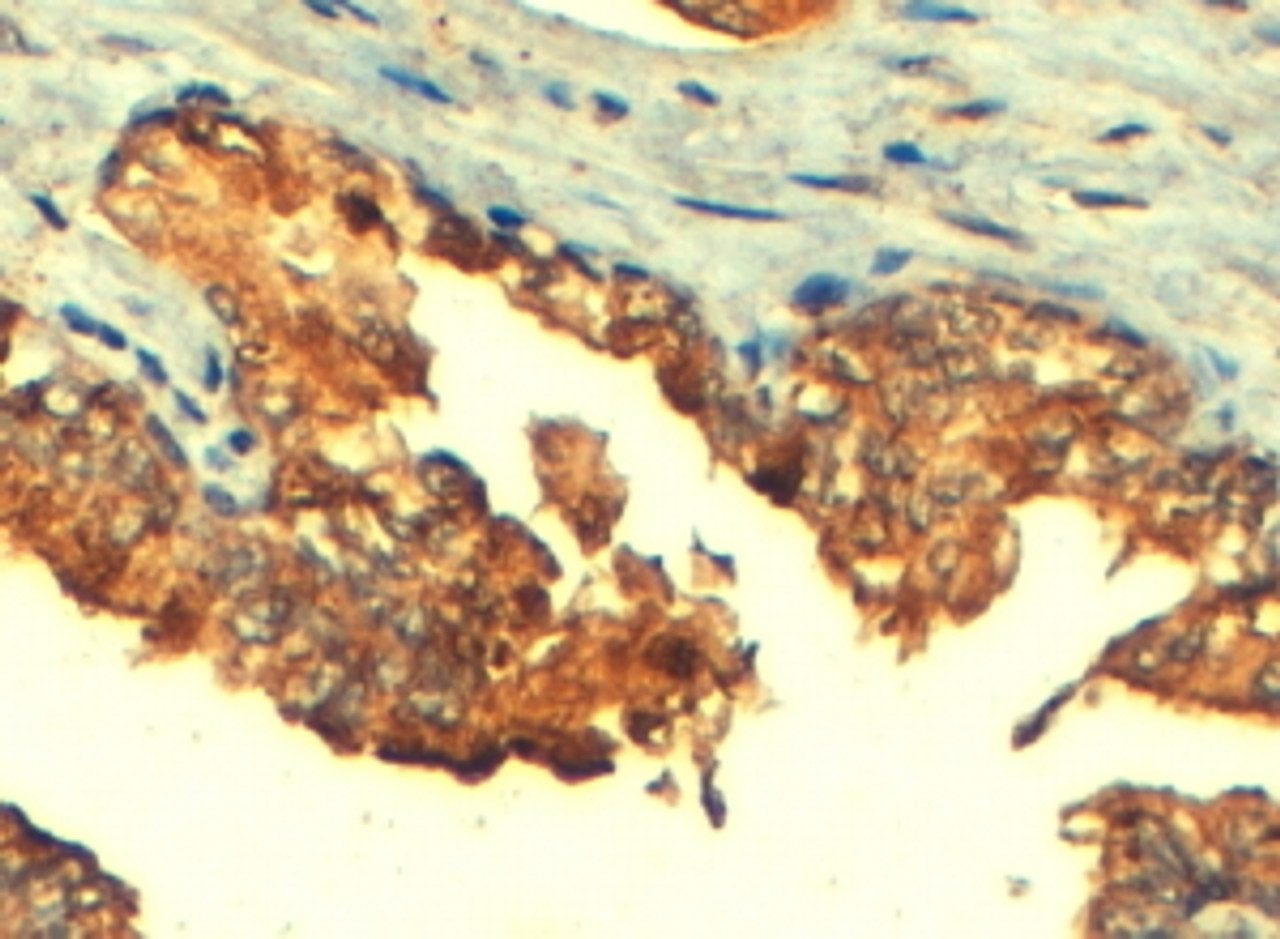 45-181 (4ug/ml) staining of paraffin embedded Human Prostate. Steamed antigen retrieval with citrate buffer pH 6, HRP-staining.