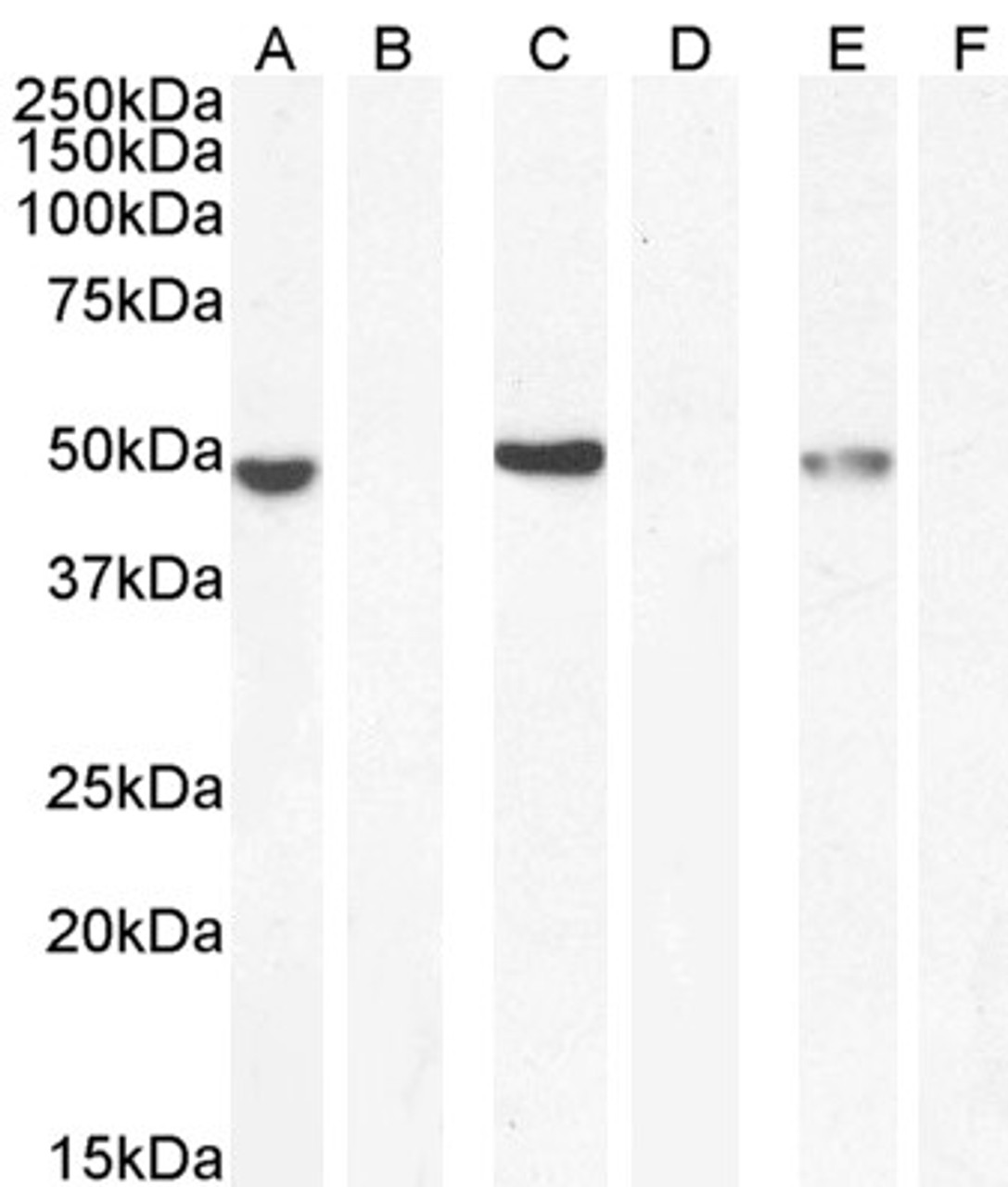 43-158 (0.01ug/ml) staining of HeLa lysate (35ug protein in RIPA buffer) . Primary incubation was 1 hour. Detected by chemiluminescence.