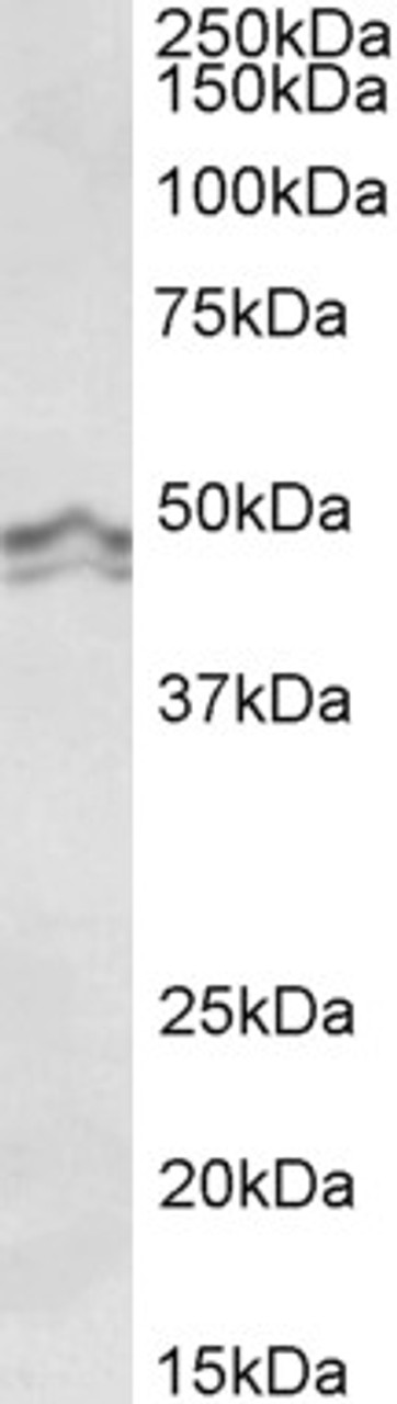 43-160 (1ug/ml) staining of HeLa (A) and Jurkat (B) nuclear lysate (35ug protein in RIPA buffer) . Primary incubation was 1 hour. Detected by chemiluminescence.