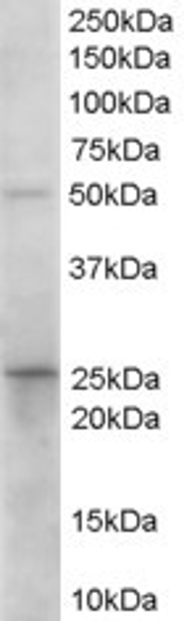 45-070 (0.1ug/ml) staining of Human Duodenum lysate (35ug protein in RIPA buffer) . Primary incubation was 1 hour. Detected by chemiluminescence.