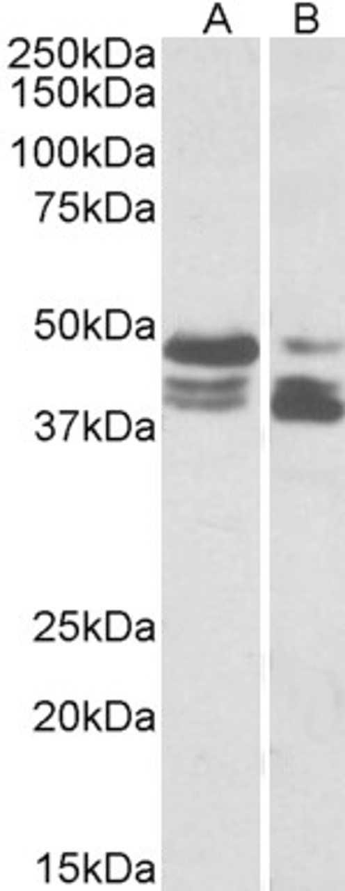 43-177 (5ug/ml) staining of paraffin embedded Human Skeletal Muscle. Steamed antigen retrieval with citrate buffer pH 6, AP-staining.