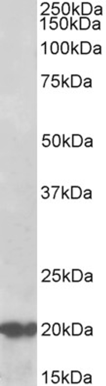 43-182 (0.3ug/ml) staining of Human Skin lysate (35ug protein in RIPA buffer) . Primary incubation was 1 hour. Detected by chemiluminescence.