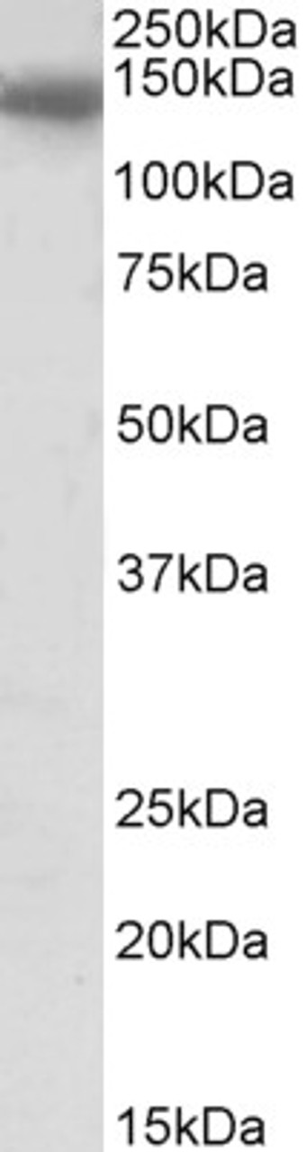 43-193 (0.5ug/ml) staining of Rat Skeletal Muscle lysate (35ug protein in RIPA buffer) . Primary incubation was 1 hour. Detected by chemiluminescence.