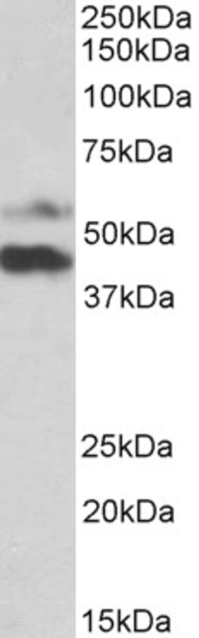 43-202 (0.03ug/ml) staining of HeLa (lane 1) and Human Colon cancer (lane two) lysate (35ug protein in RIPA buffer) . Primary incubation was 1 hour. Detected by chemiluminescence.