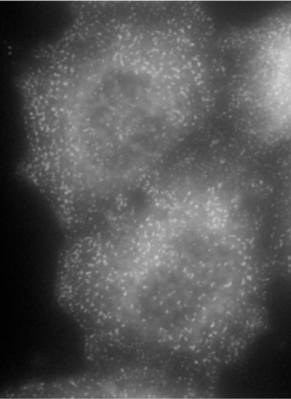 43-209 (1ug/ml) staining of Human Colorectal Cancer lysate (35ug protein in RIPA buffer) . Detected by chemiluminescence.
