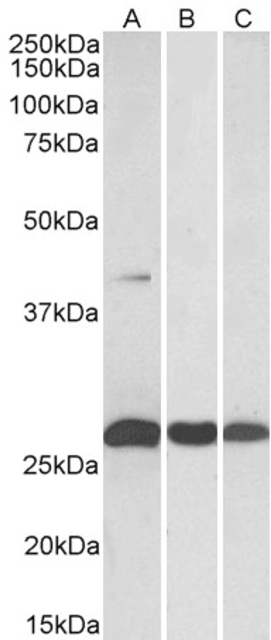 43-216 (1ug/ml) staining of Human Breast lysate (35ug protein in RIPA buffer) . Primary incubation was 1 hour. Detected by chemiluminescence.