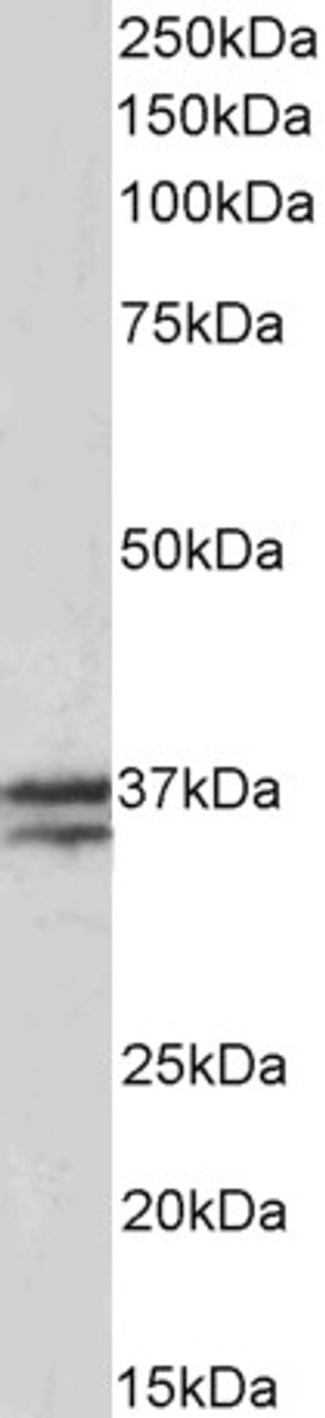 43-222 (5ug/ml) staining of paraffin embedded Human Skeletal Muscle. Steamed antigen retrieval with citrate buffer pH 6, AP-staining.