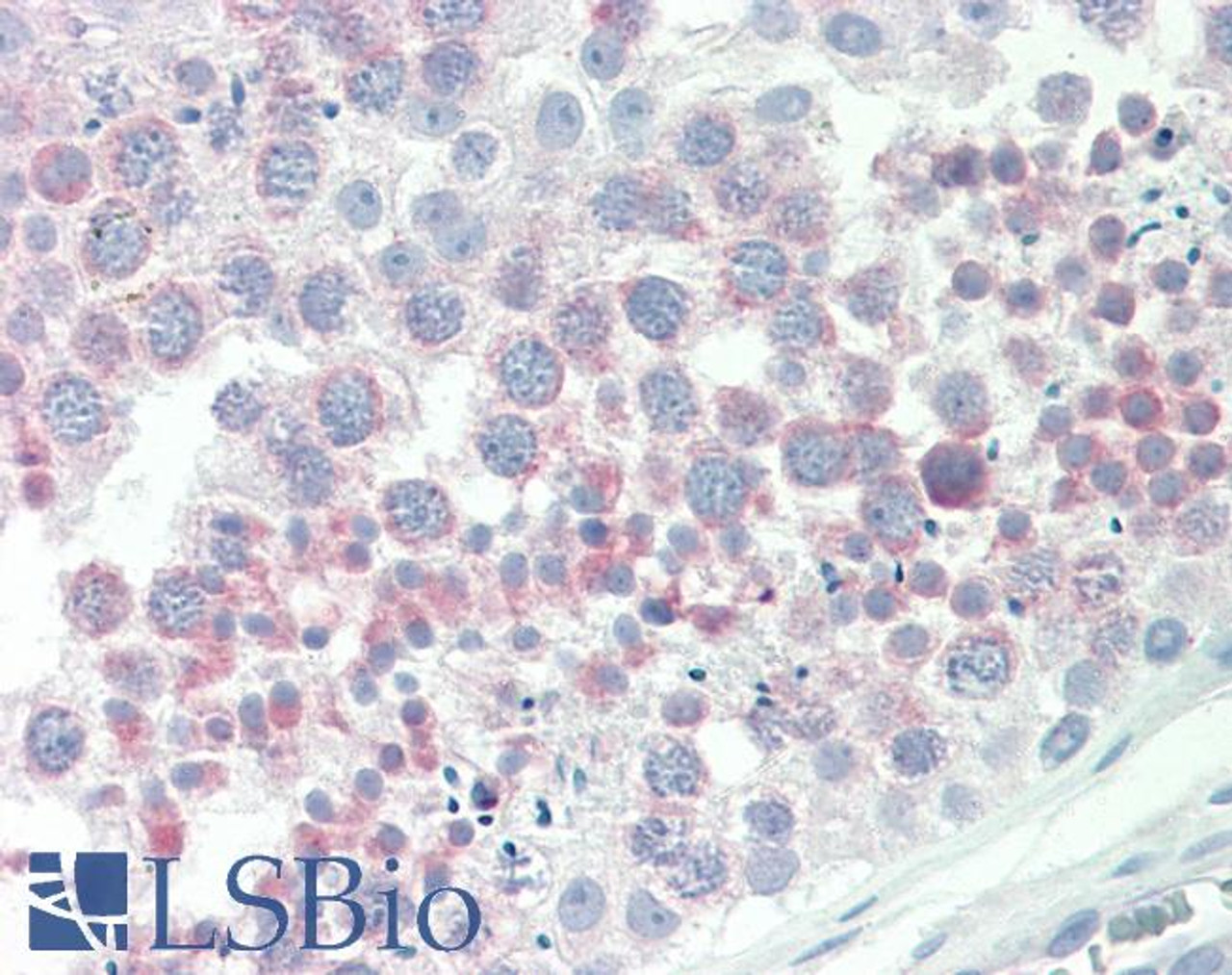 43-249 (0.1ug/ml) staining of Mouse Heart lysate (35ug protein in RIPA buffer) . Primary incubation was 1 hour. Detected by chemiluminescence.