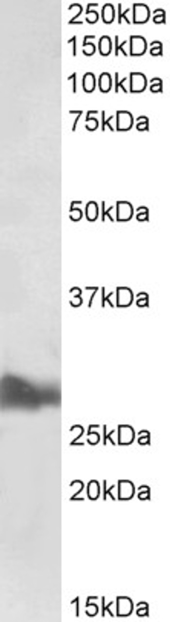 43-251 (0.1ug/ml) staining of Human Lung lysate (35ug protein in RIPA buffer) . Primary incubation was 1 hour. Detected by chemiluminescence.