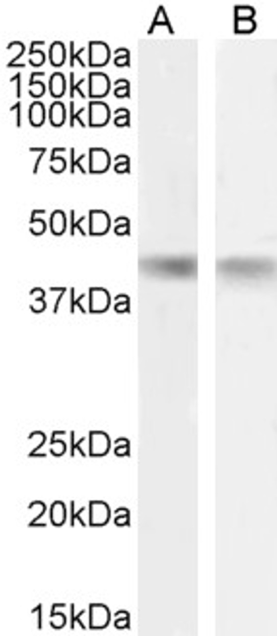 43-256 (0.3ug/ml) staining of Human Spleen lysate (35ug protein in RIPA buffer) . Detected by chemiluminescence.