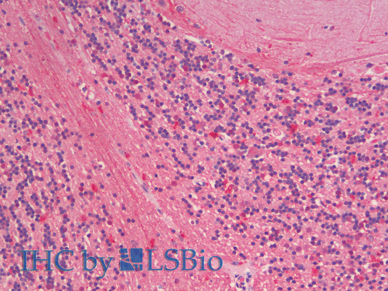 43-267 (2ug/ml) staining of Cerebral Cortex ysate (35ug protein in RIPA buffer) . Primary incubation was 1 hour. Detected by chemiluminescence.